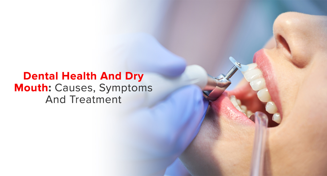 How Teeth Polishing Can Improve Your Oral Health & Smile